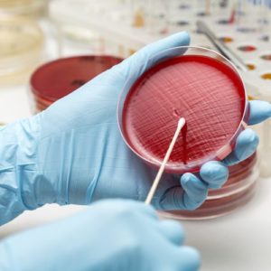 Microbial Identification & Susceptibility