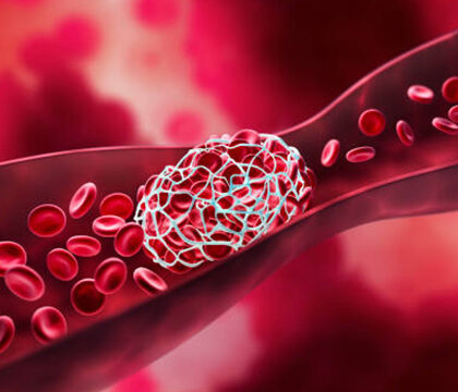 Coagulation