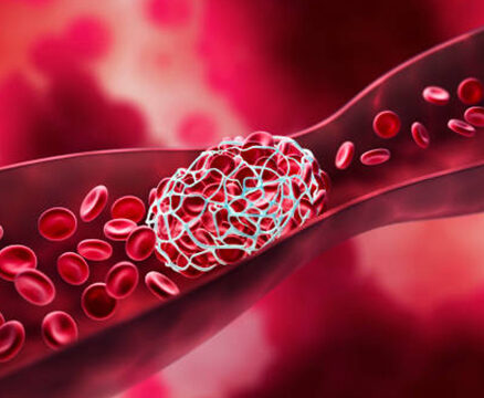 Coagulation