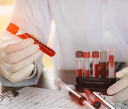 Hematology