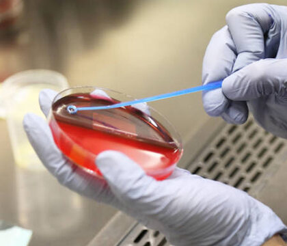 Blood-Culture
