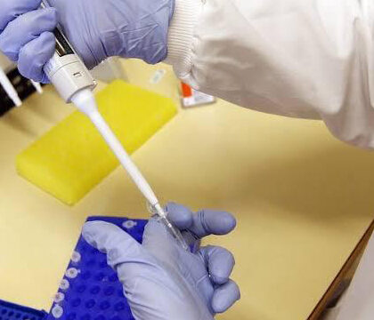 Biochemical-tests